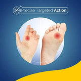 Scholl Verruca and Wart Remover Freeze Treament, 80ml